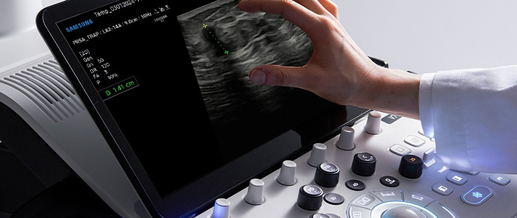 Nový špičkový ultrazvuk na KLINICE SILESIA